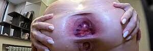 Huge spread butthole